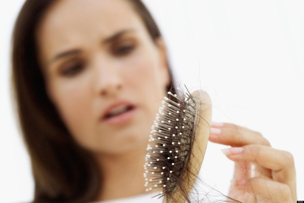 pérdida de cabello postparto